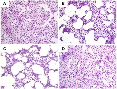 Impaired Airway Epithelial Barrier Integrity in Response to Stenotrophomonas maltophilia Proteases, Novel Insights Using Cystic Fibrosis Bronchial Epithelial Cell Secretomics